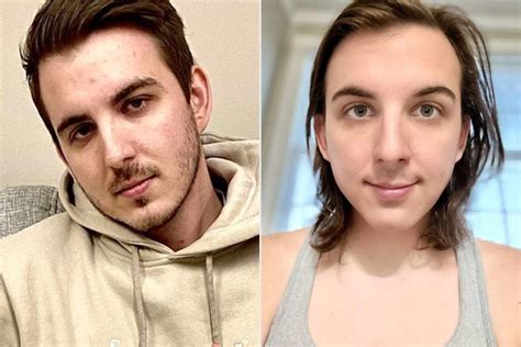 MrBeast YouTube Star Chris Tyson Shows Off Transformation After