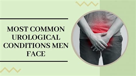 What Are The Most Common Urological Conditions Men Face Ssurocare