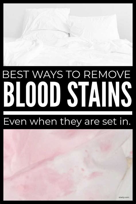 How To Remove Old Blood Stains From Clothes Artofit