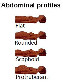 Health Assessment Abdomen Flashcards Quizlet