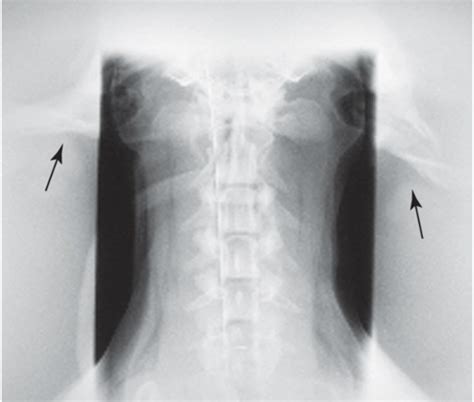 Radiology Chapter 9 Flashcards Quizlet