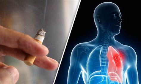 Lung Cancer ‘light Cigarettes Make Smokers More Vulnerable Express