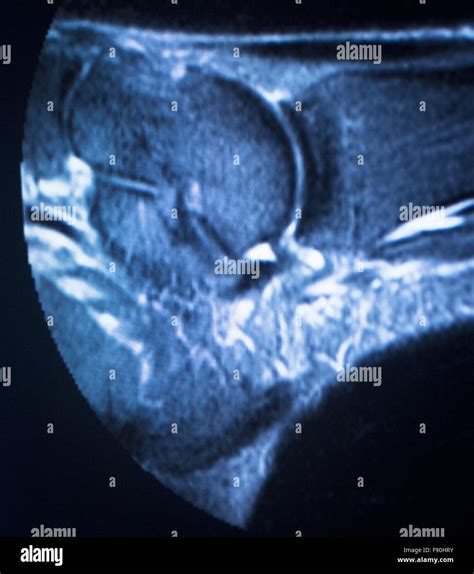 Mri Magnetic Resonance Imaging Medical Scan Test Results Showing