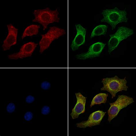 Hla Abc Polyclonal Antibody Pa5 115363