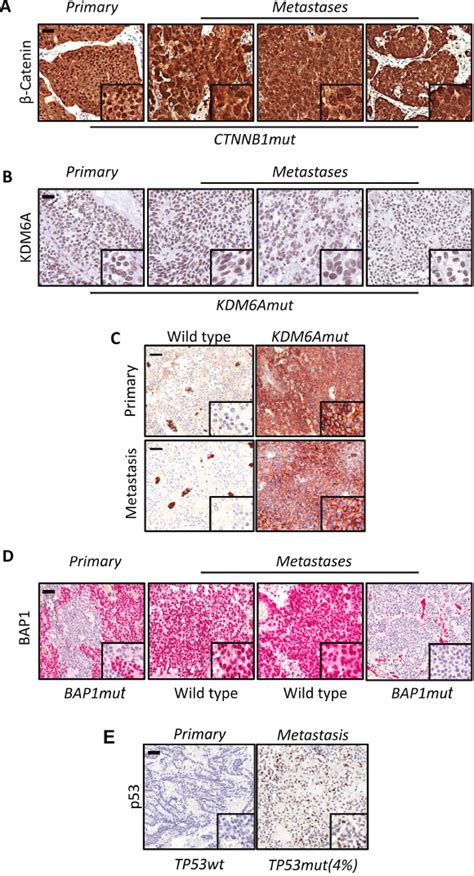 Comparative Lesions Analysis Through A Targeted Sequencing Approach