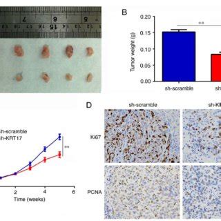 Knockdown Of Krt Decreases Tumor Growth In Vivo A And B The Size