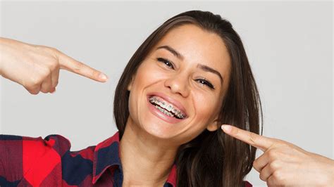 Teeth Braces Types Of Orthodontic Braces Age Limit Getting Dental