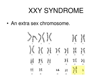 A Picture Of A Persons Chromosomes Ppt Download