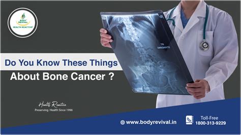 Do You Know These Things About Bone Cancer Body Revival Health Reactive Cancer Treatment