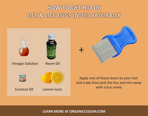 How To Get Rid Of Head Lice Out Of Your House At Robert Cuadrado Blog