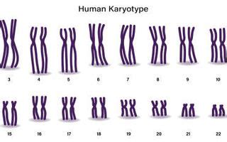 Human Karyotype Disorders by Kpowell - Curipod