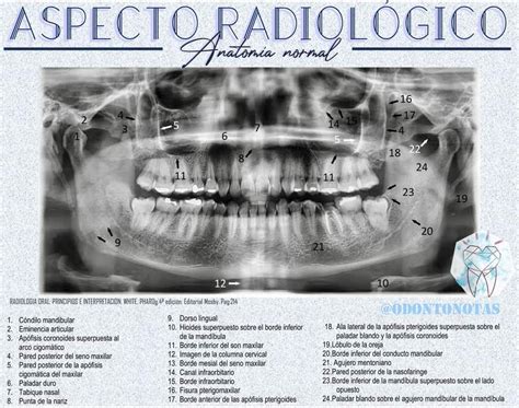 Pin Di Jessica Rocio Su Odonto Denti