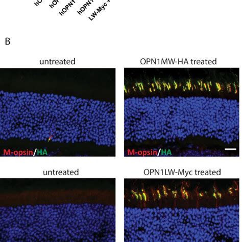 M Cone Erg Responses And Human M And L Opsin Expression In