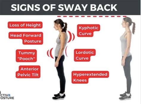 How To Fix Sway Back Posture Fitness Blind