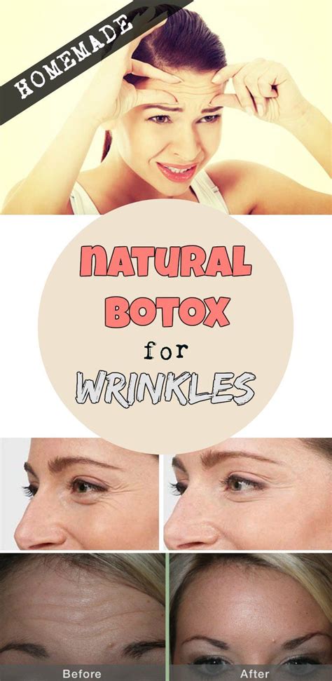 Natural Botox For Wrinkles Homemade Natural Botox Botox Wrinkles