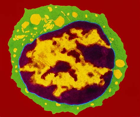 Coloured Tem Of A T Lymphocyte White Blood Cell Photograph By Cnri