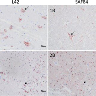 Intracellular PrP Sc Accumulation In Brain Sections Of Moose With CWD