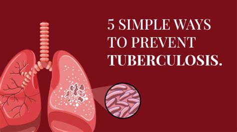 Tuberculosis Tb Symptoms Types Diagnosis And More Rela Hospital