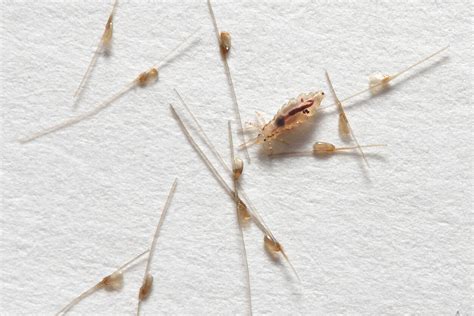 Ciclo De Vida De La Pediculosis Capitis