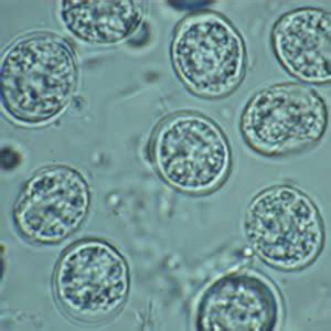 Toxoplasma - Definition, Gondii, Life Cycle, Morphology and Treatment