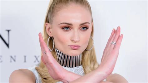 Did Sophie Turner Undergo Surgery What Is Buccal Fat Surgery