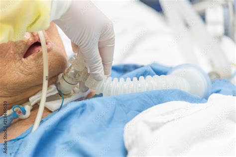 Patient Do Tracheostomy And Ventilator In Hospital Stock Photo Adobe