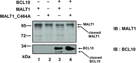 MALT1 Autoprocesses Itself In Vitro His Tagged BCL10 His Tagged MALT1