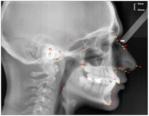 Diagnostics Free Full Text Investigation Of The Relationship