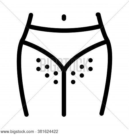 Hairy Bikini Zone Vector Photo Free Trial Bigstock