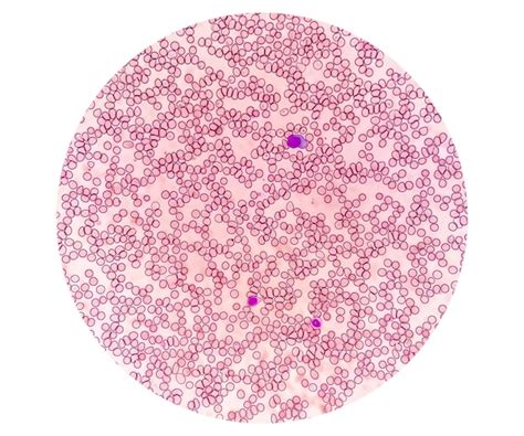 Thrombocytes Under Microscope