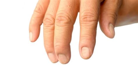 Brittle Nails Causes And 12 Natural Remedies Well Being Secrets