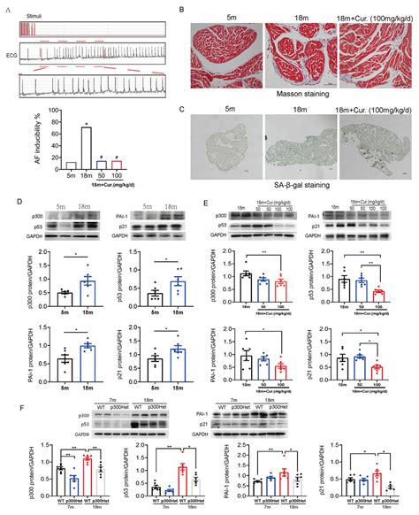 Involvement of plasminogen activator inhibitor-1 in p300/p53-mediated ... 