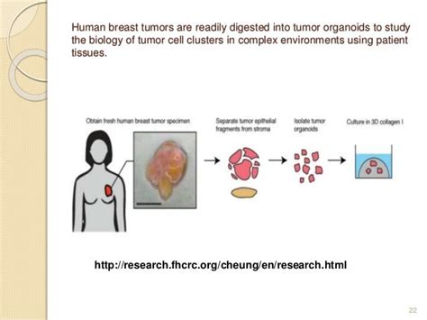 Organoid Culture In Cancer