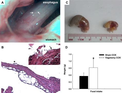 Anterior Subdiaphragmatic Vagotomy Decreases The Iga Antibody Response