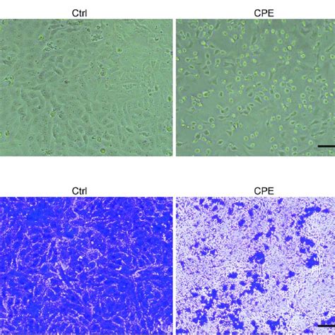 Detection Of Virus Titer By Tcid50 Assay A Illustrative Overview Of Download Scientific