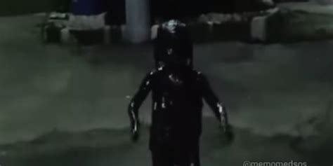Orangtua Ini Kaget Melihat Bocah Kecebur Got Sekujur Tubuhnya Berwarna