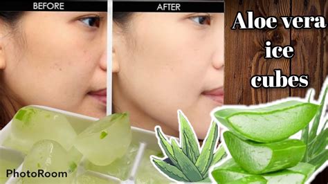 How To Make Aloe Vera Ice Cubes For Skin Whitening And Glowing Get