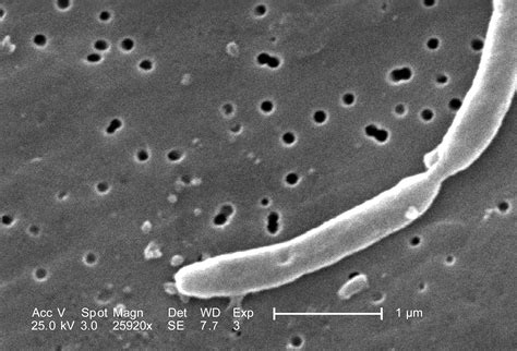 Free Picture Morphological Details Two Joined Gram Negative