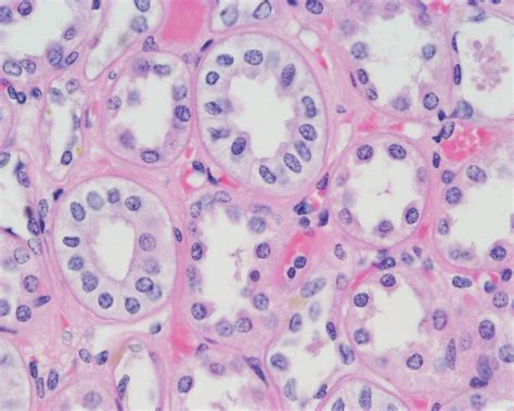 Stratified Cuboidal Epithelium Labeled