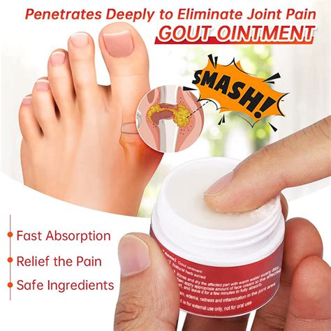 Jual South Moon Bunion Pain Relief Cream Gout Ointment Cream Krim