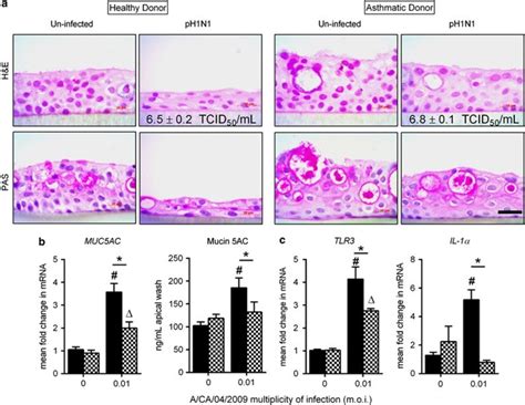 Human Bronchial Epithelial Cells From Healthy And Asthmatic Donors