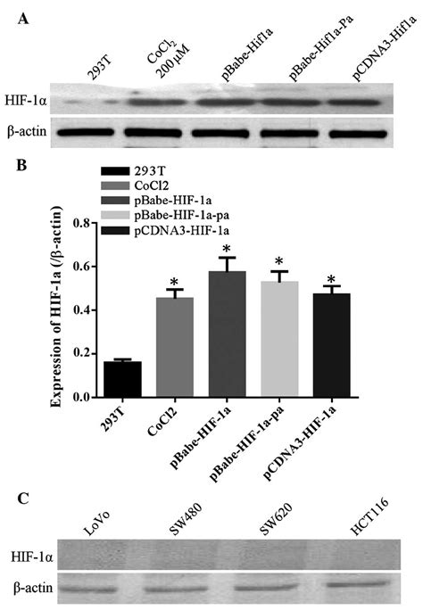 Establishment Of A Colorectal Cancer Nude Mouse Visualization Model Of