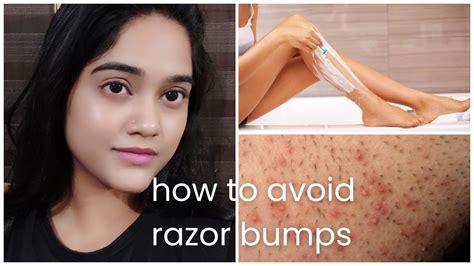 4 Ways To Avoid Razor Bumps 🪒 Sahi Tarike Seh Skin Shaved Kijiye Aur