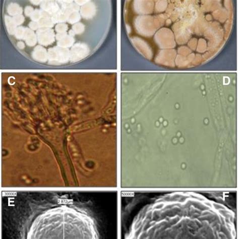 Macro And Microscopical Features Of Aspergillus Parasiticus Colonies