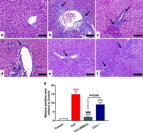 Bmscs Attenuate Fibrosis In Ccl Intoxiacted Rats Af Mt Staining Of