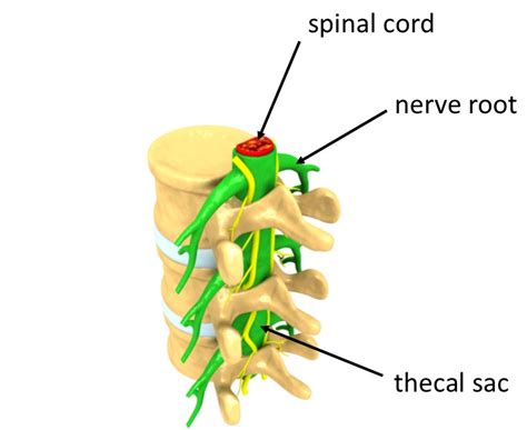 A simple understanding of sciatica - the anatomy involved - Living Well ...