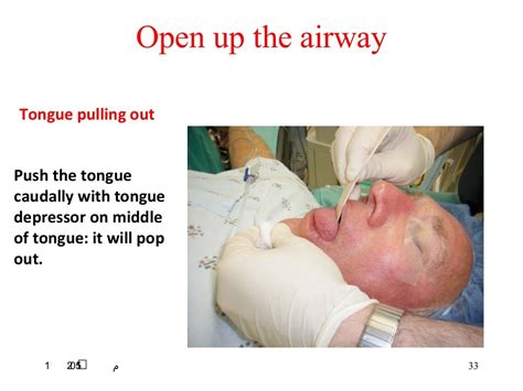 Fiberoptic intubation