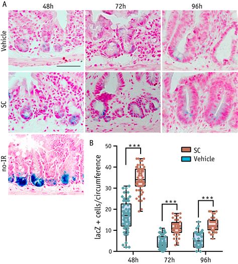 CBP P300 Inhibitors Mitigate Radiation Induced GI Syndrome By Promoting