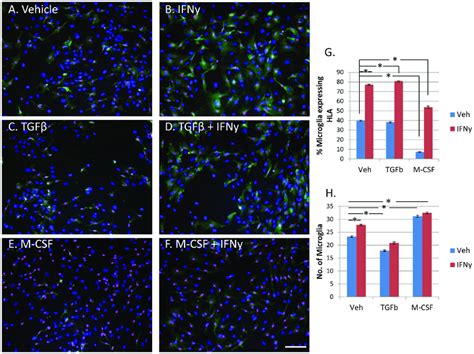 Microglial Expression Of Hla Dp Dq Dr Is Increased By Ifny Not