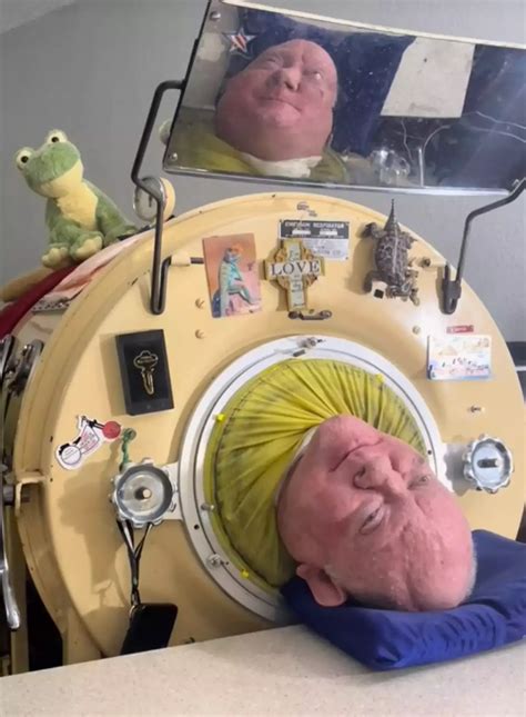 How It Was Possible For Man To Survive Inside Iron Lung For 70 Years Health Ladbible